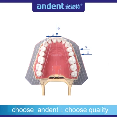 Placa de guía transparente dental de dientes